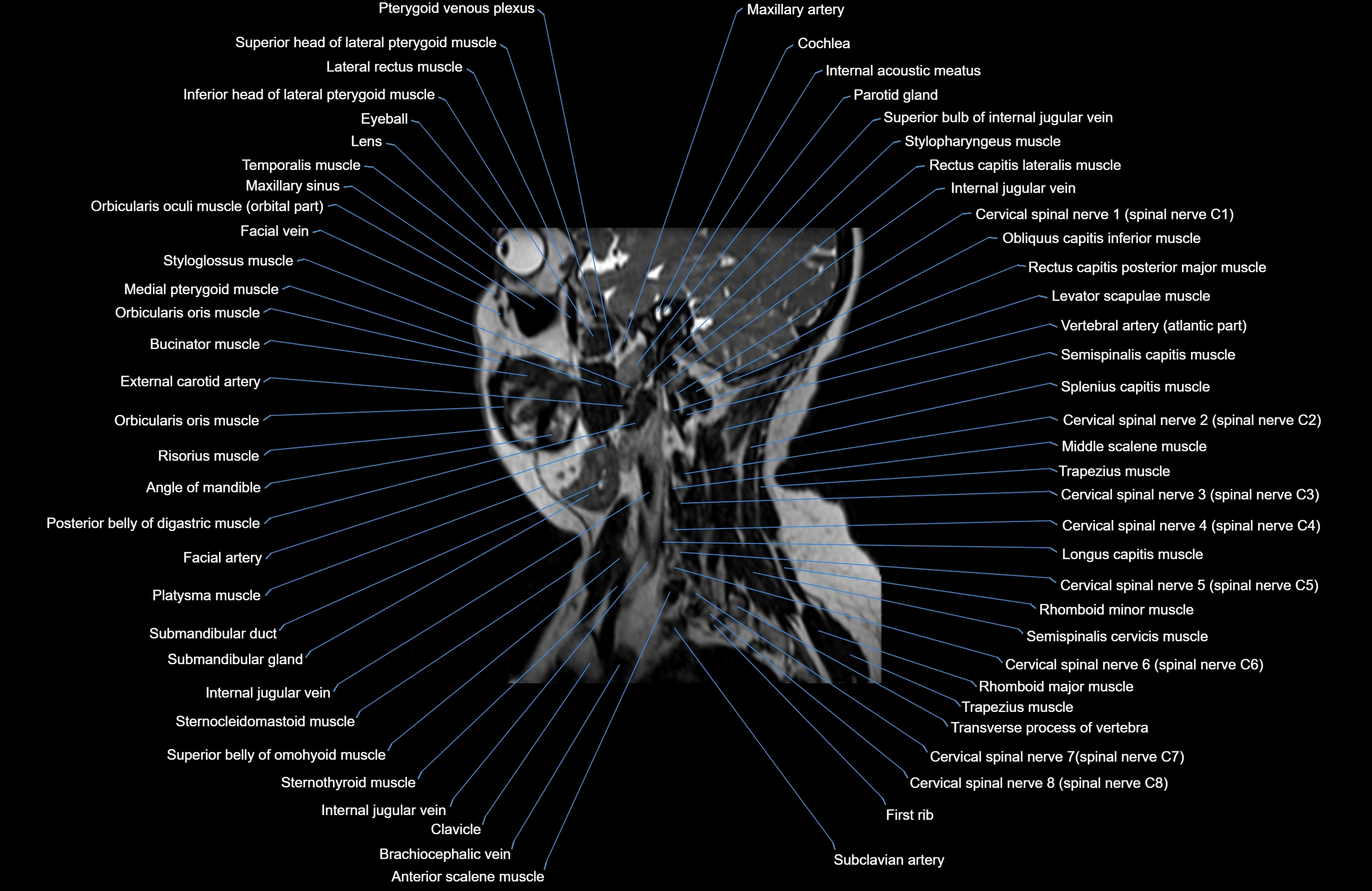 Neck MRI sagittal cross sectional anatomy 3D 1mm 3T radiology  image-img-00001-00021.webp